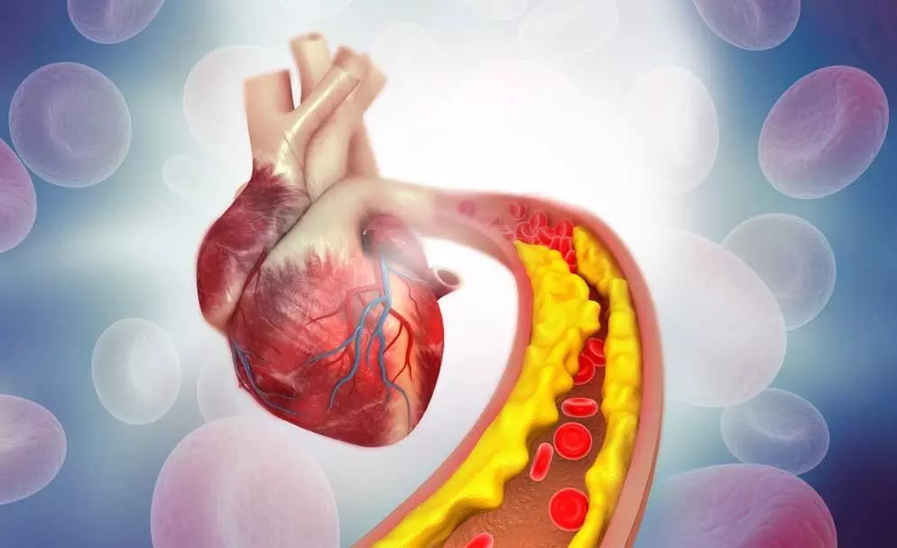 हृदय स्वास्थ्य: 6 विशेषज्ञ युक्तियाँ जो कोलेस्ट्रॉल के स्तर को कम करने में मदद कर सकती हैं, जानिये कौन - कौन सी है