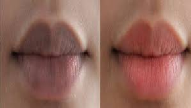 Lip Pigmentation Remedy