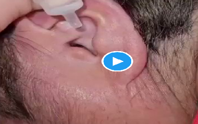 Spider In Ear Trick To Remove It: