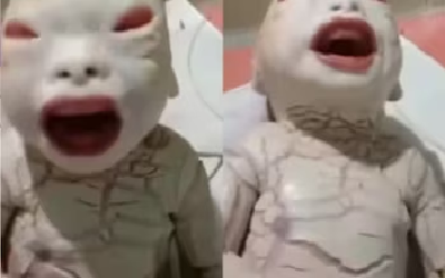 Unique Child Birth News : महिला ने एलियन जैसी शक्ल के बच्चे को दिया जन्म, डॉक्टर्स भी रह गए हैरान! देखें VIDEO...